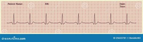 Cardiogram Cartoon Vector | CartoonDealer.com #25633781