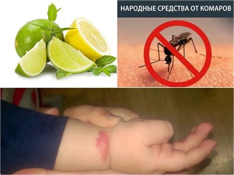 Укус комара у ребенка: реакция, сыпь, чем мазать, фото