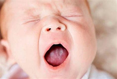 Стоматит заразный или нет для окружающих?