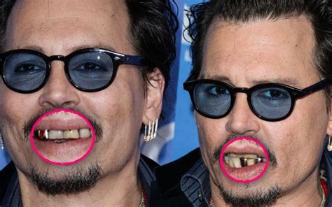 Former Sex Symbol Johnny Depp Spotted With Yellow Teeth