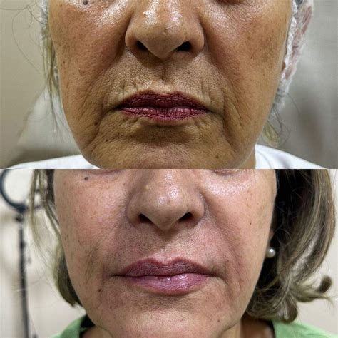 Comece 2025 mais jovem e com a beleza em alta sem gastar muito