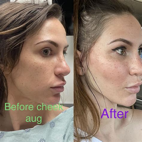 Jen Psaki's Plastic Surgery Journey: A Timeline Of Transformations Image 16