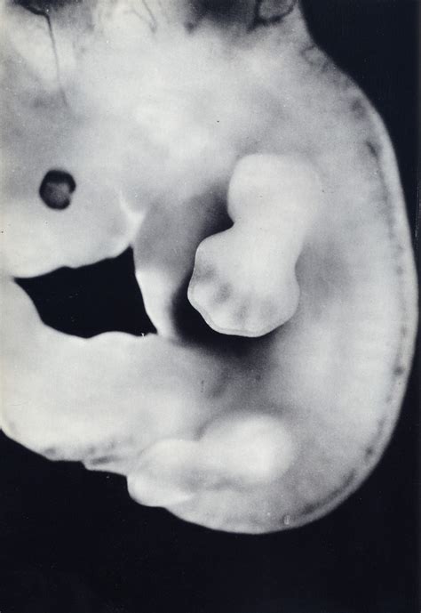 Lennart Nilsson A Child is Born — DOP