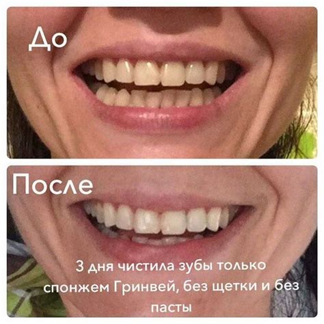 Спонжи для зубов