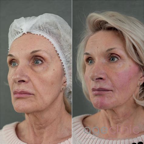Клиника эстетической медицины и косметологии в Москве | Age Clinic