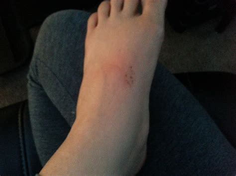 Alinity on Twitter: "Hurt my foot while streaming :( http://t.co