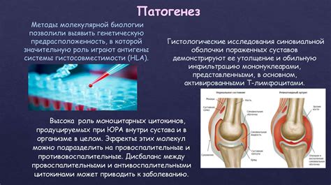 Ювенильный ревматоидный артрит - online presentation