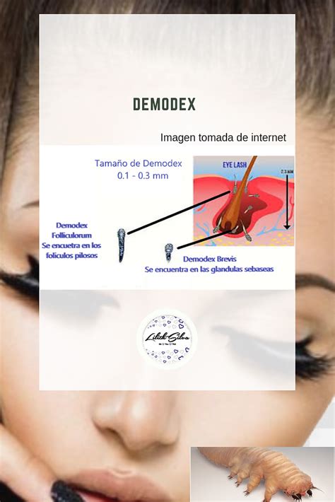 LOS DEMODEX "ÁCAROS"