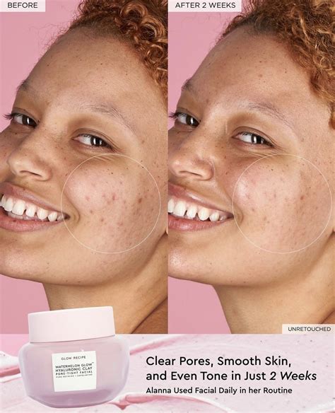 SOCIAL / DIGITAL: Alana for Glow Recipe • MMG Success