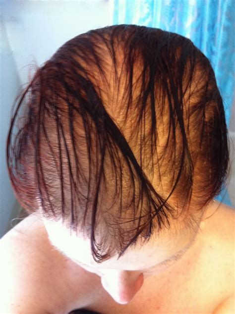 salon education editorial love  hair  thin hair chronicles