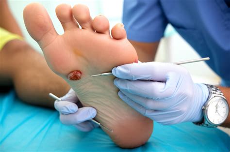 DFW Advanced Wound Care - Specialized Wound Treatment in Dallas-Fort Worth