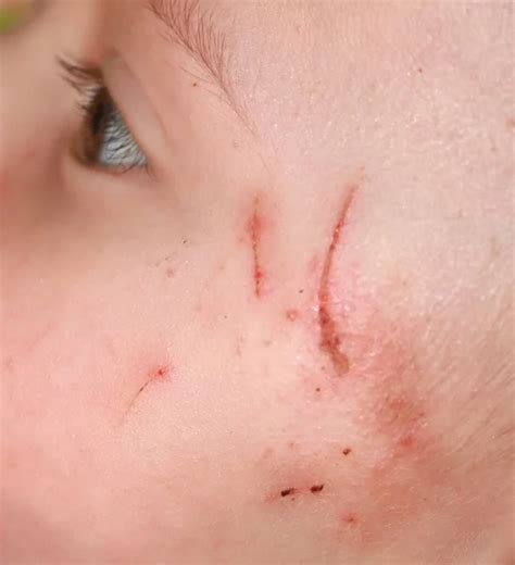 Scratches the skin Images - Search Images on Everypixel