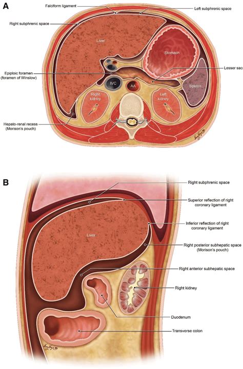 Epiploic Foramen