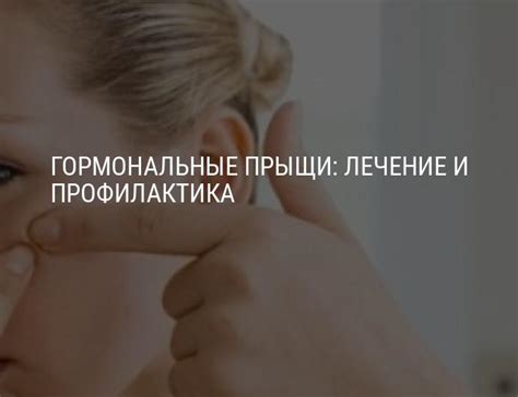 Гормональные прыщи: лечение гормональных прыщей и профилактика угревой ...