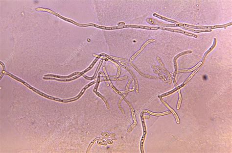 Candida albicans fungus, light micrograph - Stock Image - C057/7040 ...