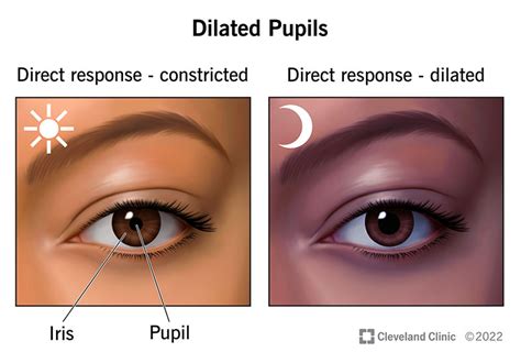 Abnormal Pupils