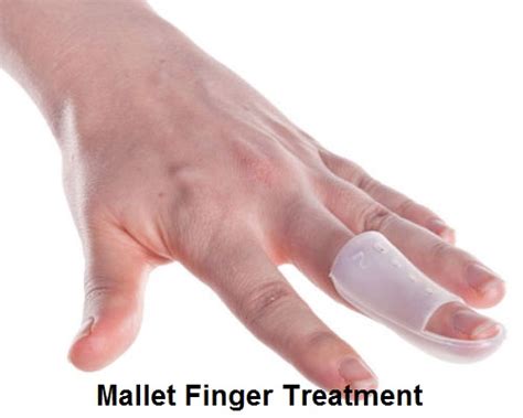 Mallet Finger Splint - Treatment | Health And Beauty