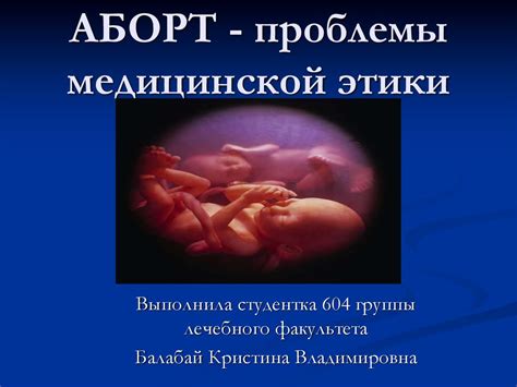 АБОРТ - проблемы медицинской этики - презентация онлайн