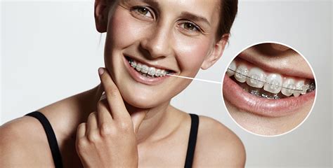 braces  adult rockaway family orthodontics