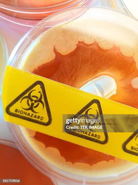 53 Mrsa Culture Stock Photos, High-Res Pictures, and Images - Getty Images