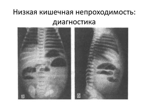 Заболевания желудочно-кишечного тракта - презентация онлайн