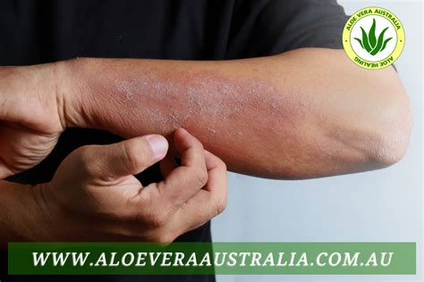 Aloe Vera in Health and Disease - Aloe Vera Australia