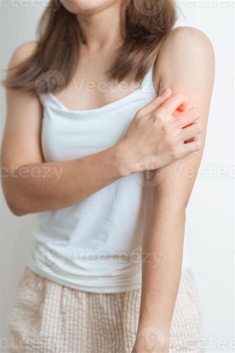 woman itching and scratching itchy arm. Sensitive Skin Allergic