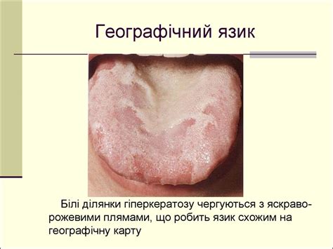 Огляд окремих частин тіла хворого - презентация онлайн
