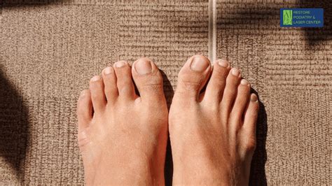 The Stages of Diabetic Neuropathy: From Mild to Severe