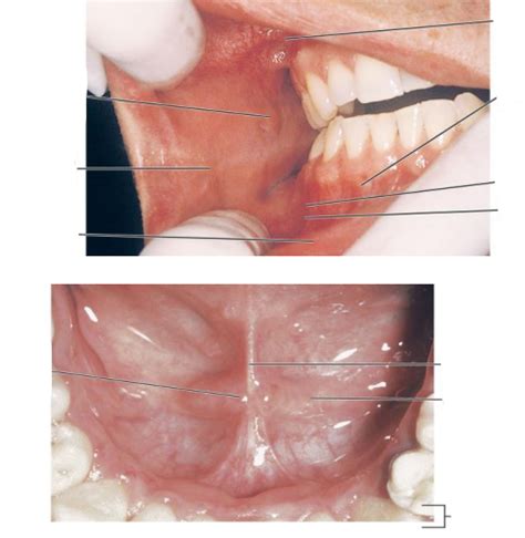 Diagram of Landmarks of oral cavity | Quizlet