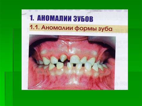 Зубочелюстные аномалии - презентация онлайн