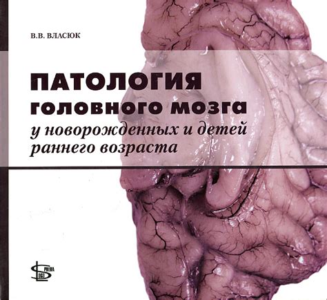 Атлас Головного Мозга Крысы - libraryeq