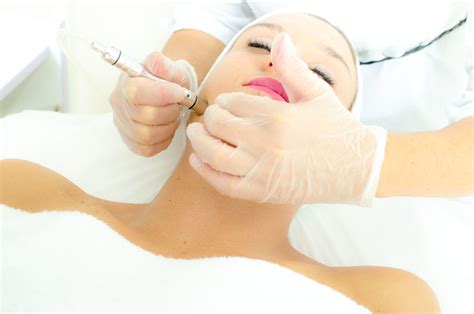 Microdermabrasion Facial: Process and Benefits