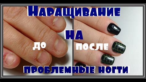 Наращивание на ПРОБЛЕМНЫХ Ногтях / Преображение Ногтей Грызунчика ...