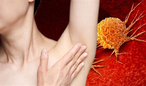 diagnose lump  skin  sophie catani blog