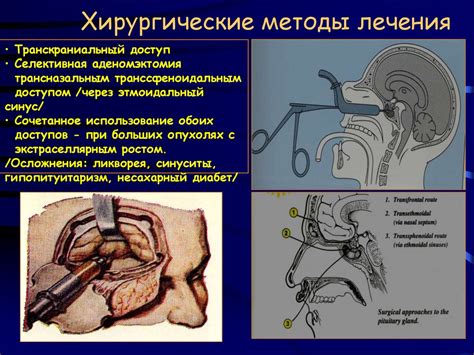 Гигантизм и акромегалия - презентация онлайн