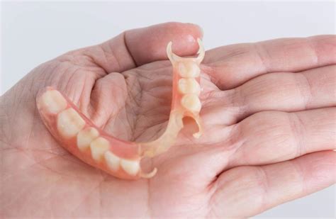 Types of Partial Dentures: How Do You Choose?
