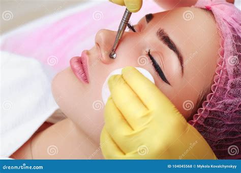Professional Cleansing of Acne in a Beauty Salon. Stock Photo - Image ...
