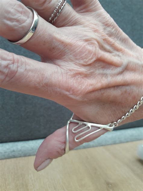 Positive Points of Hand Splints - Positive Positioning