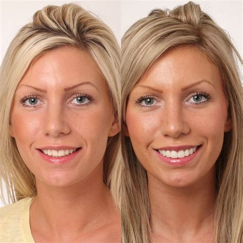 See our stunning smile gallery! - DRMR