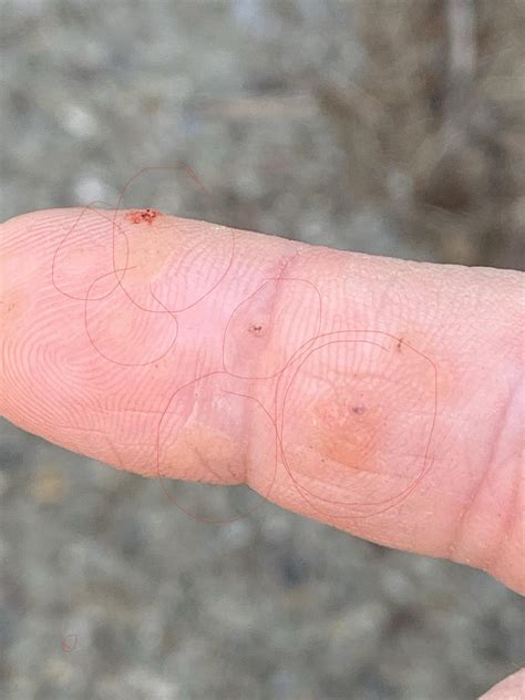 Just noticed these on my index finger. They get more noticeable in the