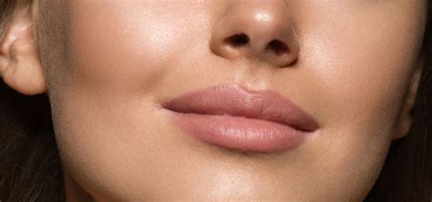 lift  define cheekbones kalologie medspa