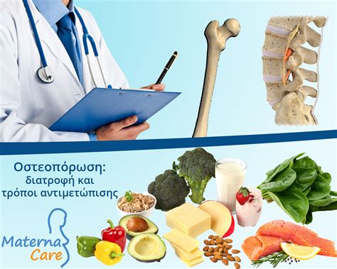 Οστεοπόρωση: διατροφικές συμβουλές και τρόποι αντιμετώπισης
