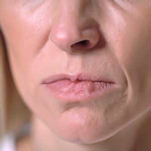 Painful Jaw Lump Symptoms, Causes & Common Questions – San Diego Health