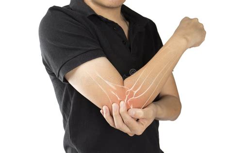 Elbow bones injury stock photo. Image of medulla, ache - 125493038