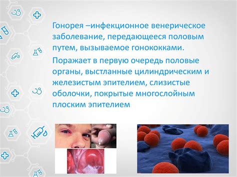 Гонорея - презентация онлайн