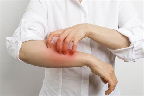 Чесотка: возможные пути заражения | MedAboutMe