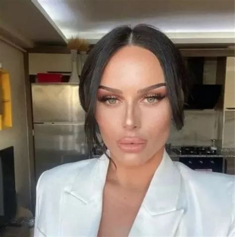 Kısmetse Olur Yaren kimdir, kaç yaşında? Kısmetse Olur Yaren’e ne oldu ...