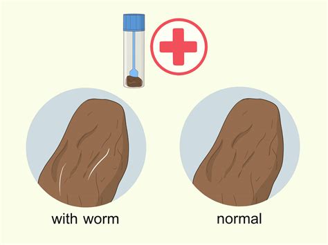 8 Formas de Eliminar Vermes do Corpo - wikiHow
