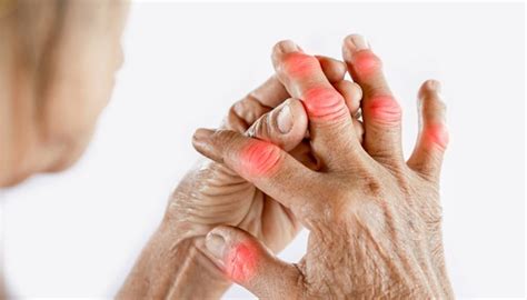 Hand Pain and Stiffness: Four Common Causes - Woodside Clinic